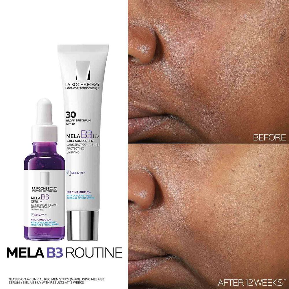 Mela B3 Dark Spot Serum & Mela B3 UV Daily Moisturizer With SPF 30 - Image 3