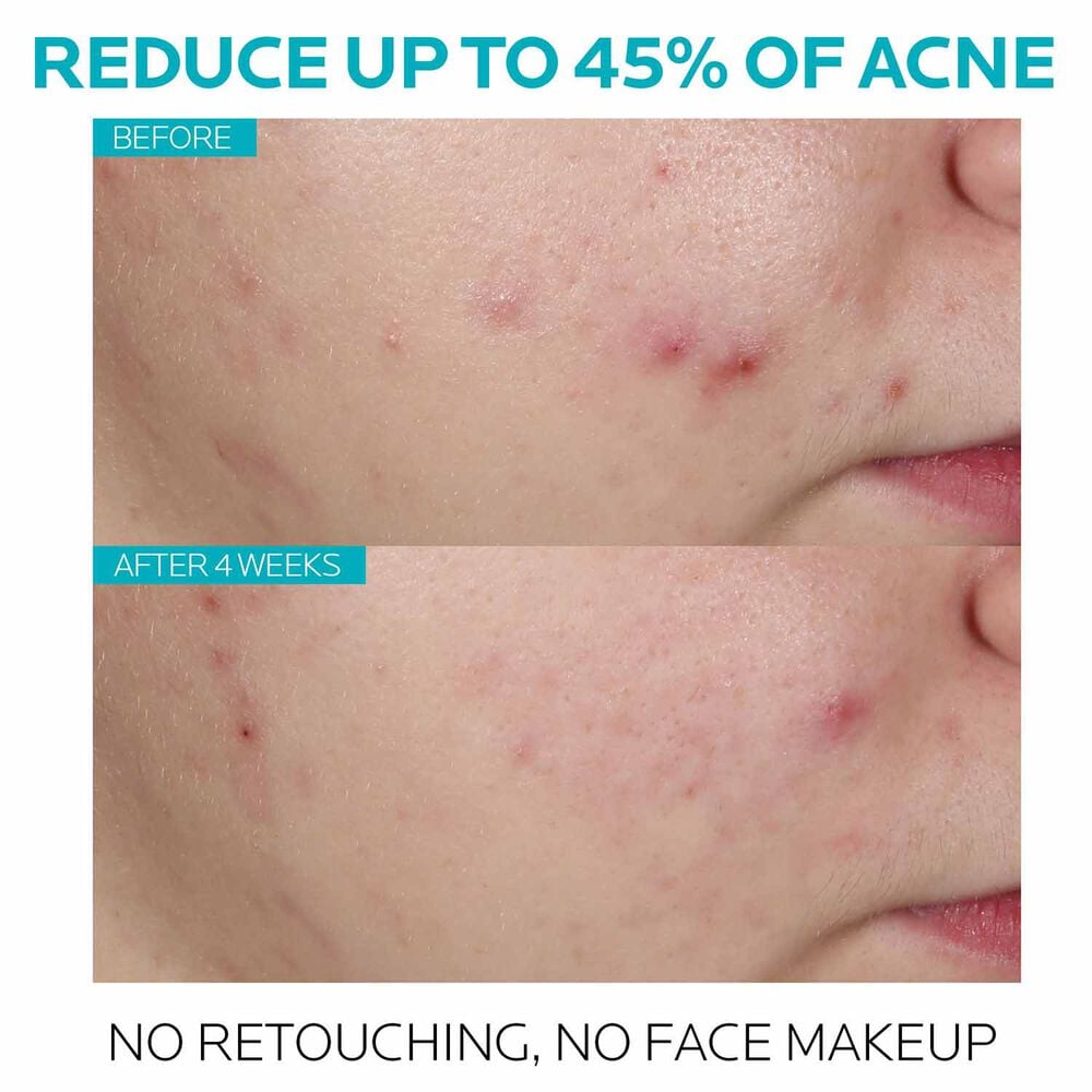 Effaclar Salicylic Acid Acne Treatment Serum - Image 5